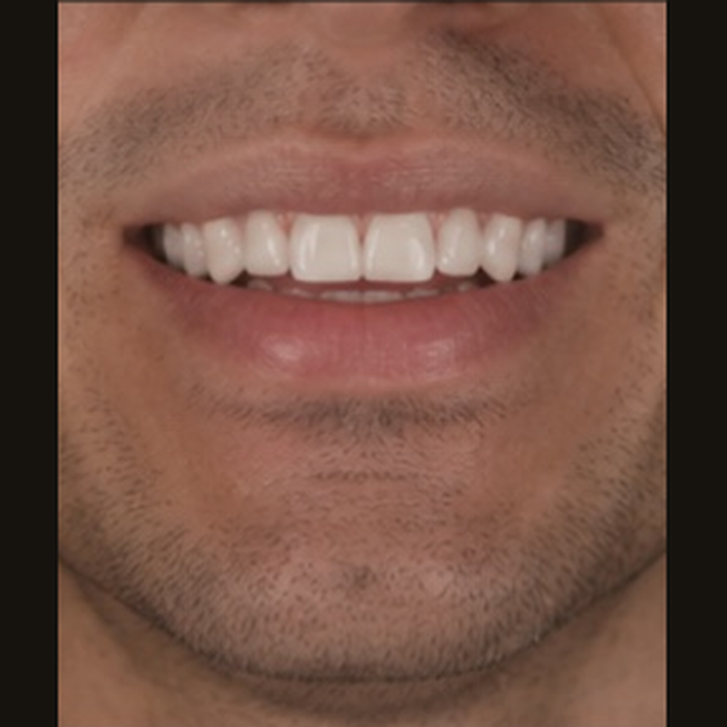 After treatment