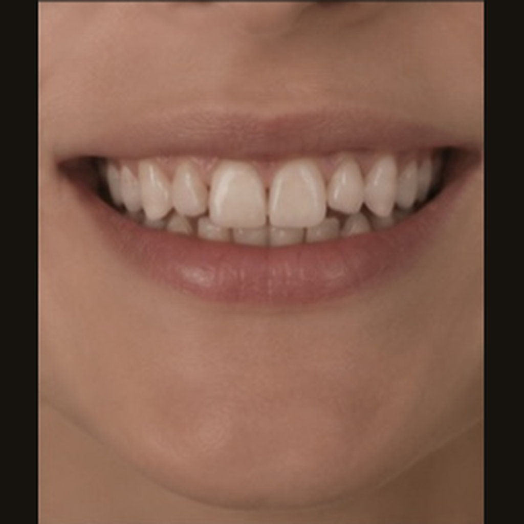 Before treatment