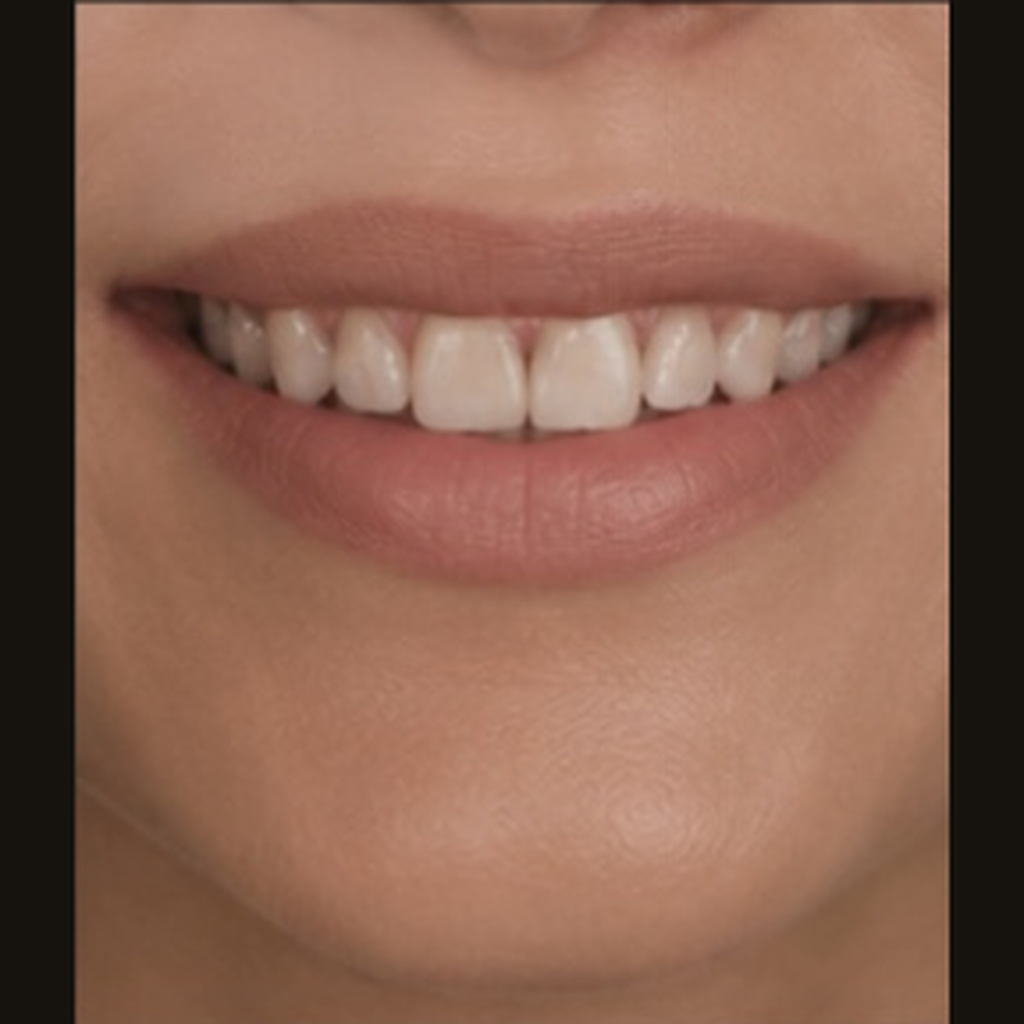 Before treatment